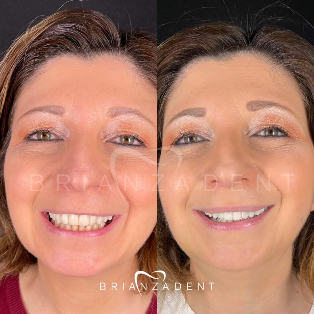 Caso reale prima/dopo