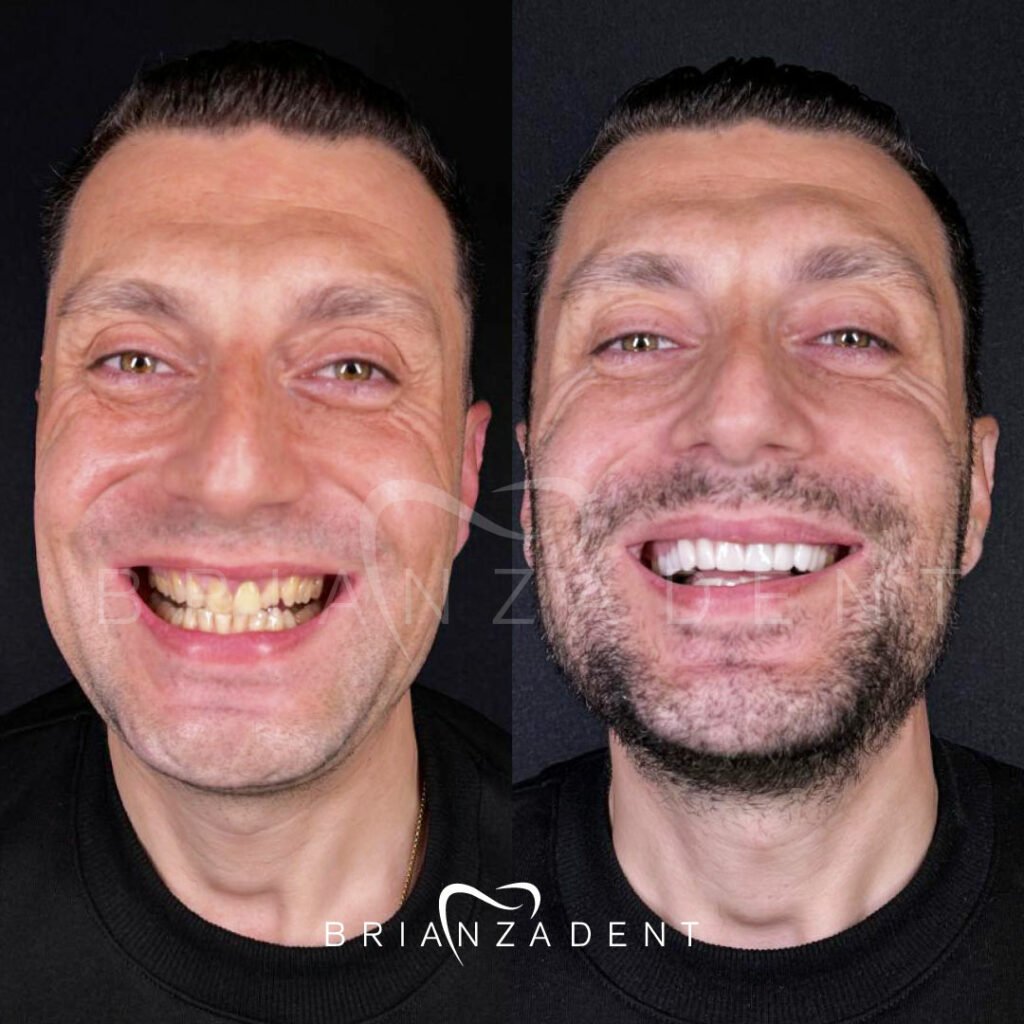 Caso reale prima/dopo