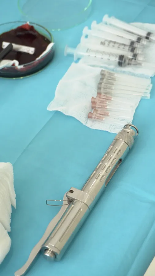 Jeringas e implantadores con los injertos foliculares alineados en el campo operatorio