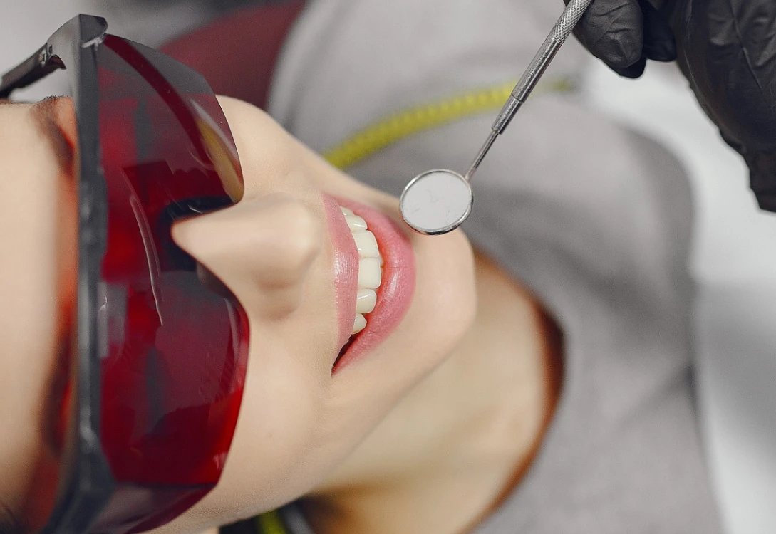 Windent — estetica dentale