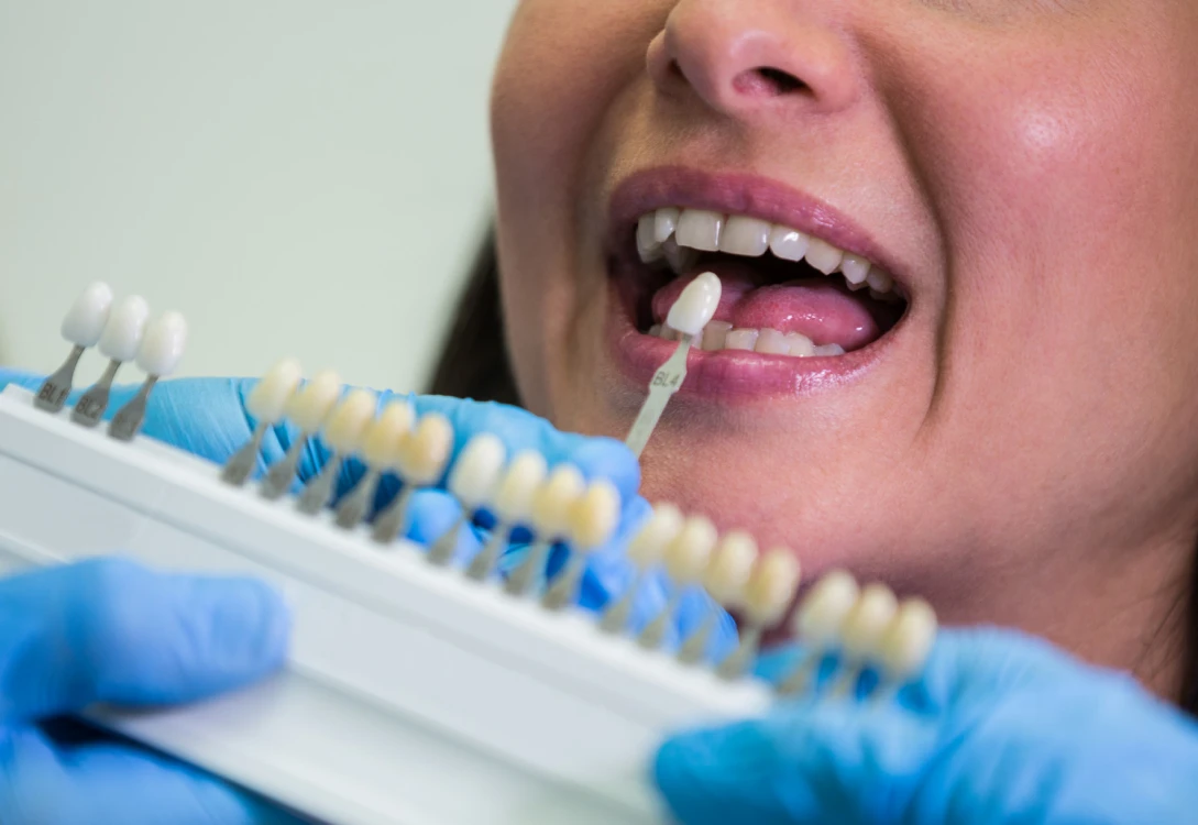 Windent — implantologia